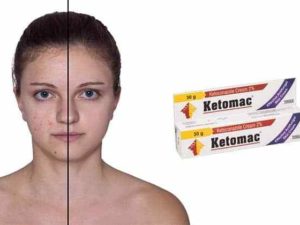 best skin infection cream in India